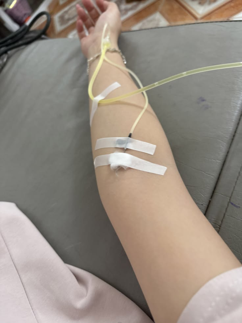 ảnh truyền nước ở tay nữ cận cảnh